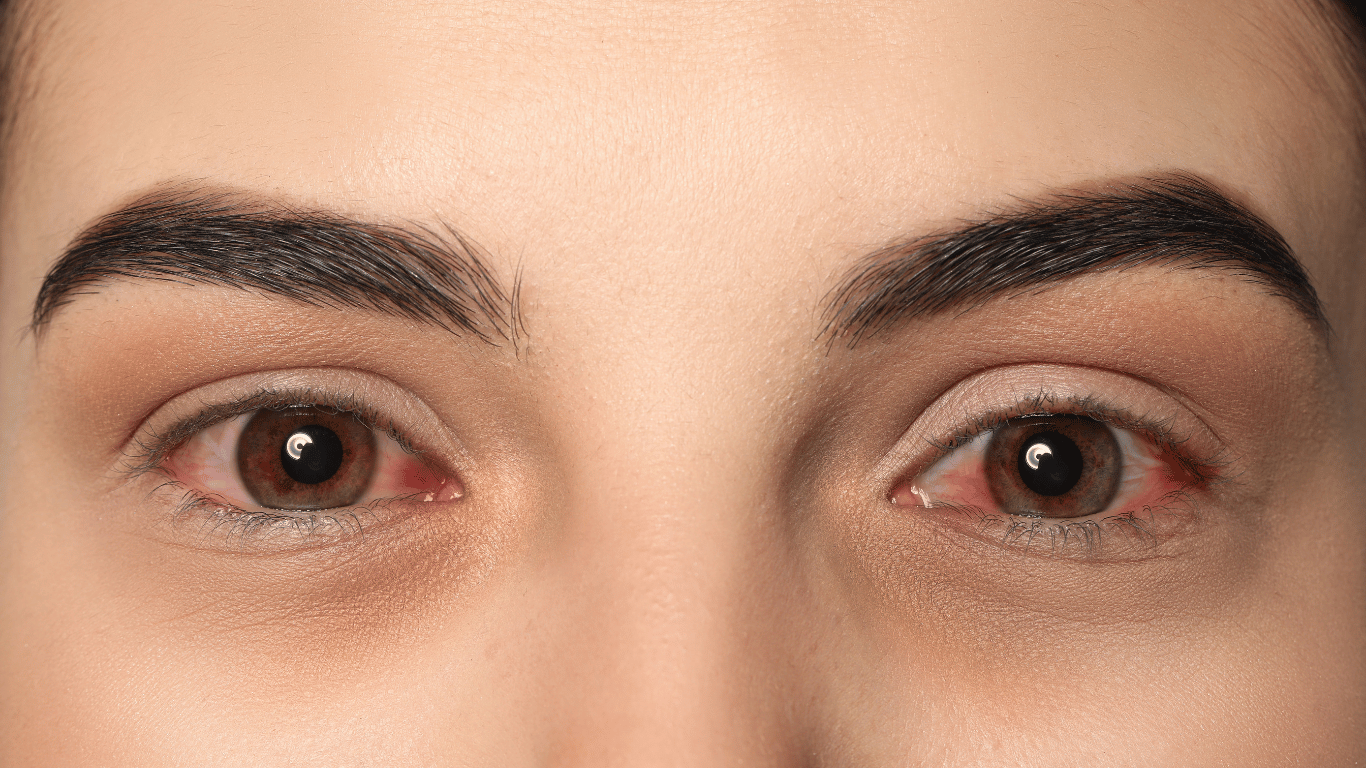Dry eye treatment service